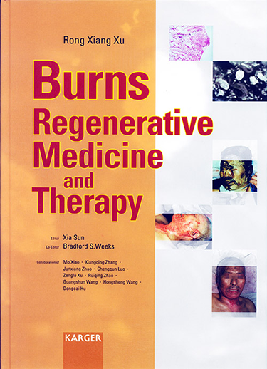 Burns Regenerative Medicine and Therapy